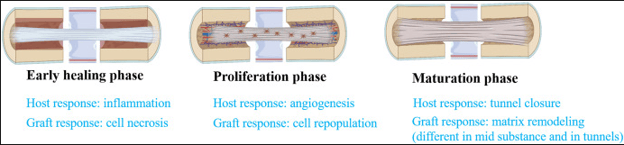 Grafts going through early, proliferation, and maturation phases.