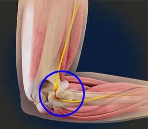 ulnar nerve entrapment diagram