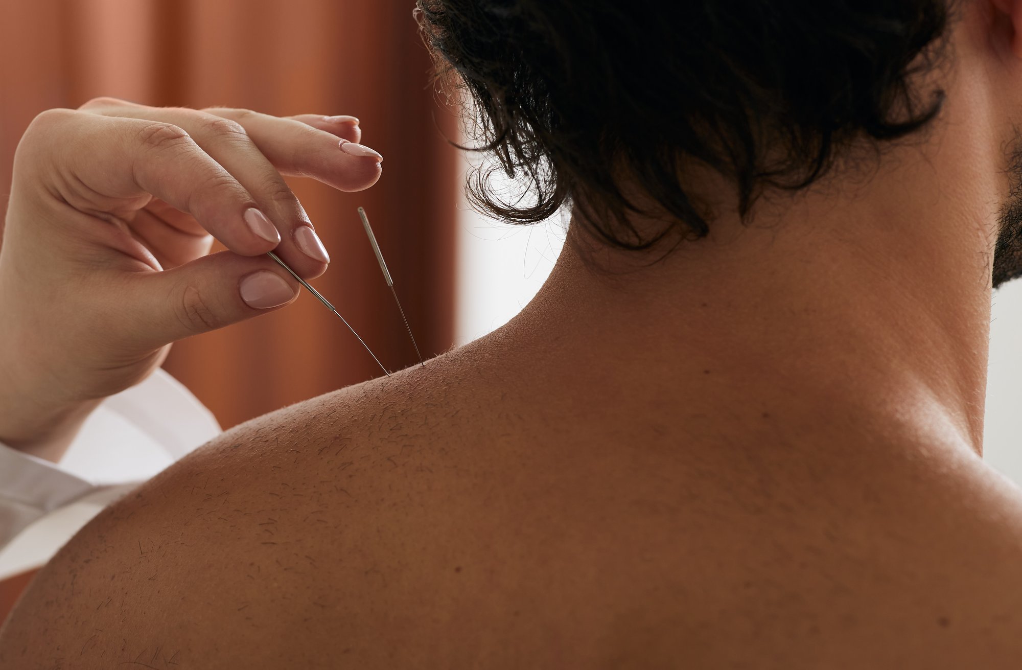 reflexologist-s-hand-with-acupuncture-needle-close-2025-03-11-21-02-52-utc