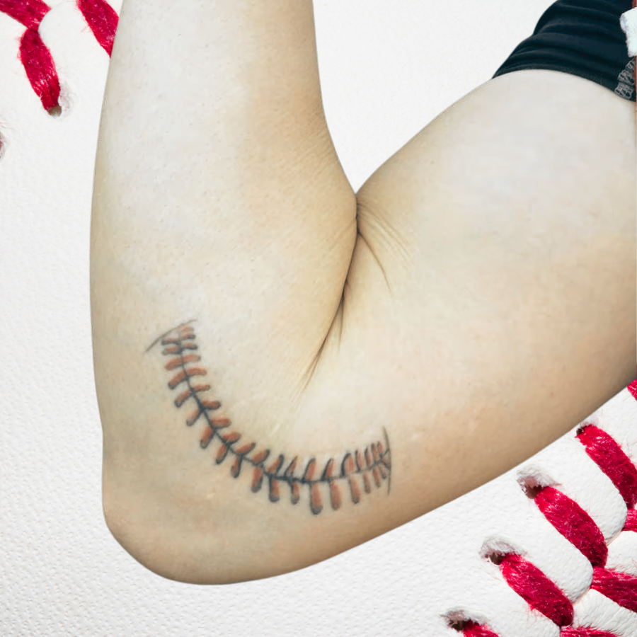Tommy John Injury (The Complete Guide)